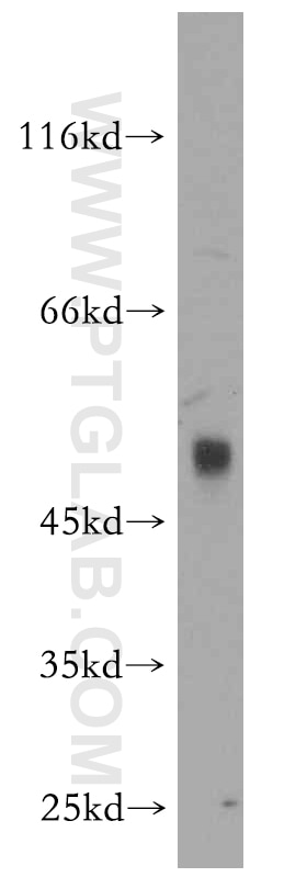 Western Blot (WB) analysis of mouse thymus tissue using Protrudin Polyclonal antibody (12680-1-AP)