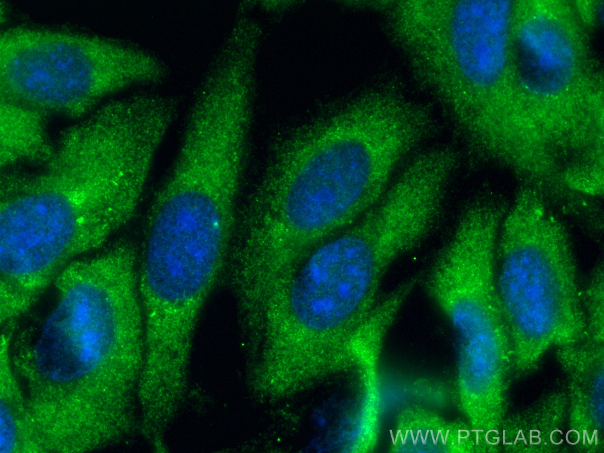 Immunofluorescence (IF) / fluorescent staining of HepG2 cells using ZFYVE28 Polyclonal antibody (25360-1-AP)