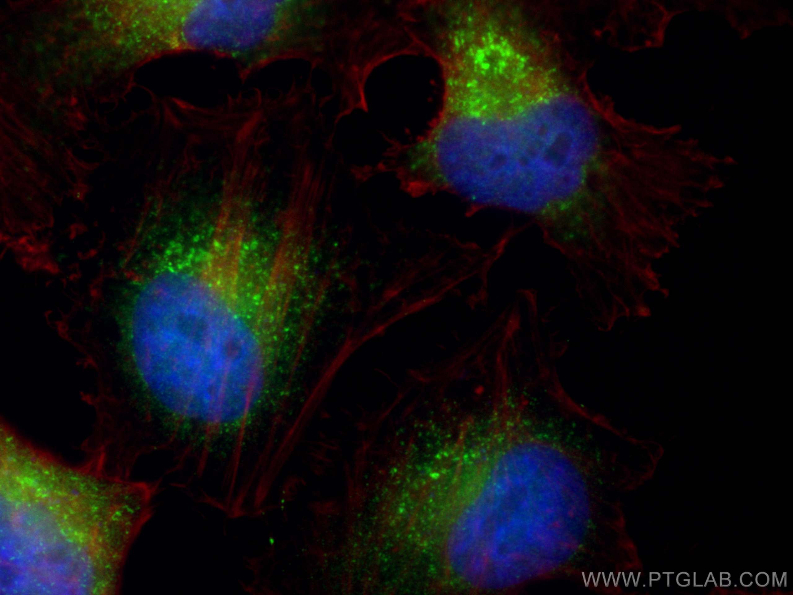Immunofluorescence (IF) / fluorescent staining of HeLa cells using ZFYVE28 Polyclonal antibody (25360-1-AP)