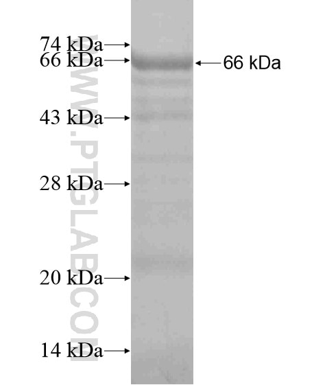 ZFYVE28 fusion protein Ag19638 SDS-PAGE ZFYVE28 fusion protein Ag19638 SDS-PAGE