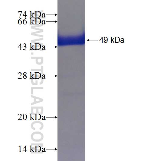 ZFYVE28 fusion protein Ag19796 SDS-PAGE