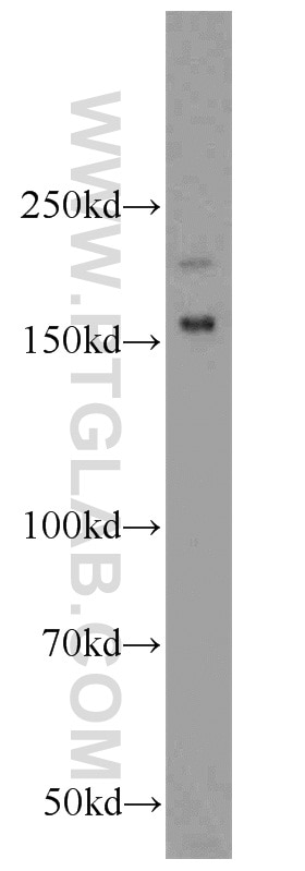 Western Blot (WB) analysis of mouse brain tissue using SARA Polyclonal antibody (14821-1-AP)