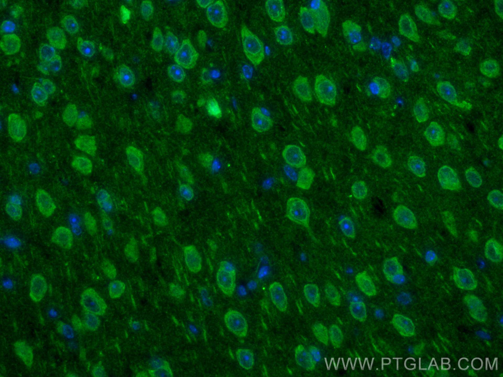 Immunofluorescence (IF) / fluorescent staining of mouse brain tissue using SARA Polyclonal antibody (22033-1-AP)