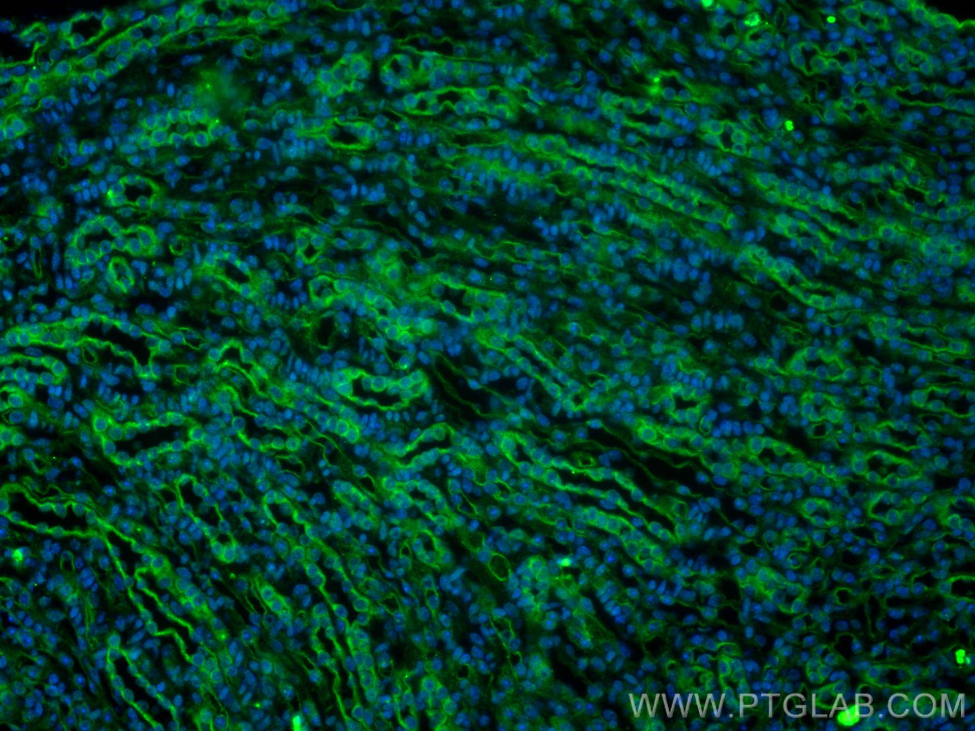 Immunofluorescence (IF) / fluorescent staining of mouse kidney tissue using SARA Polyclonal antibody (22033-1-AP)