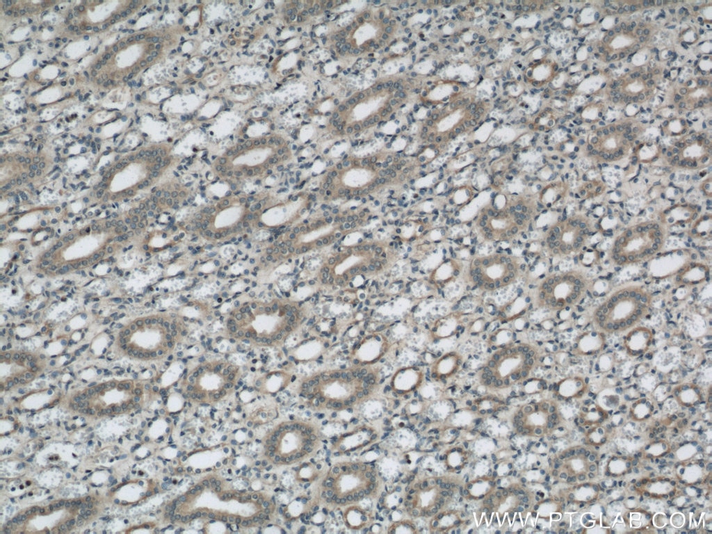 Immunohistochemistry (IHC) staining of human kidney tissue using SARA Polyclonal antibody (22033-1-AP)