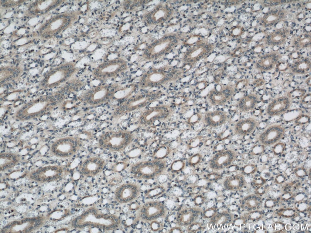 IHC staining of human kidney using 22033-1-AP