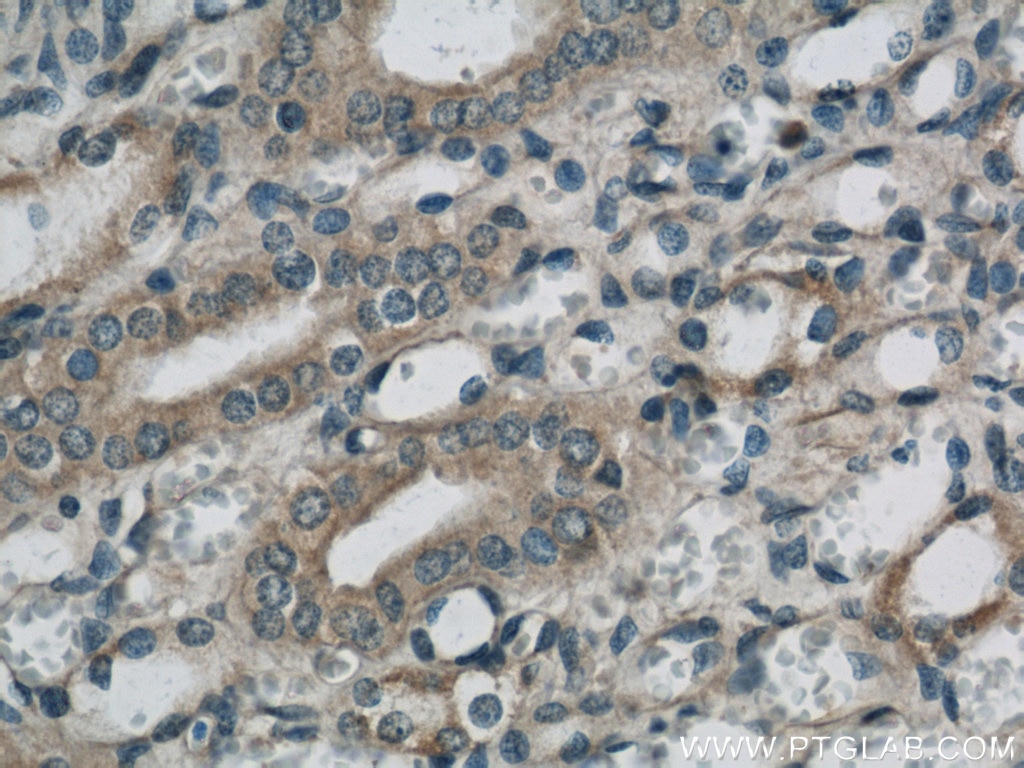 Immunohistochemistry (IHC) staining of human kidney tissue using SARA Polyclonal antibody (22033-1-AP)
