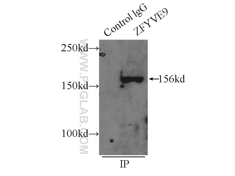 Immunoprecipitation (IP) experiment of mouse brain tissue using SARA Polyclonal antibody (22033-1-AP)