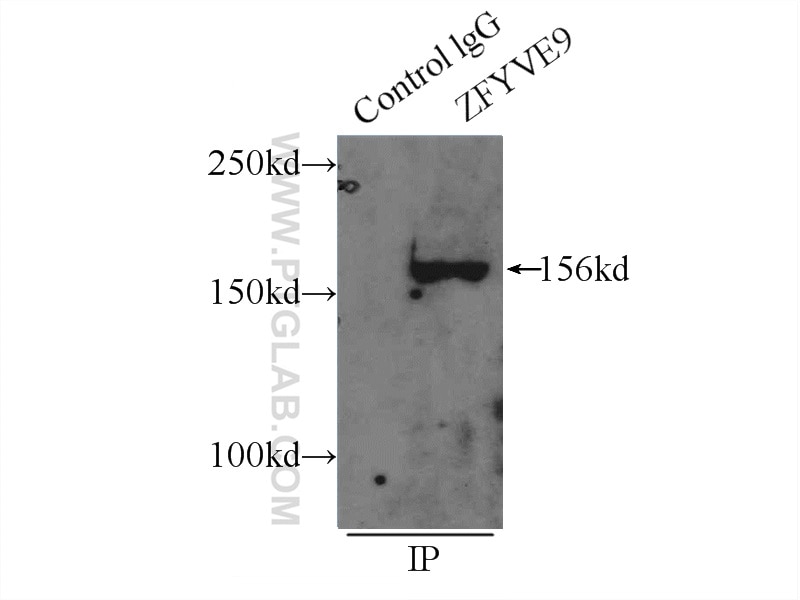 IP experiment of mouse brain using 22033-1-AP