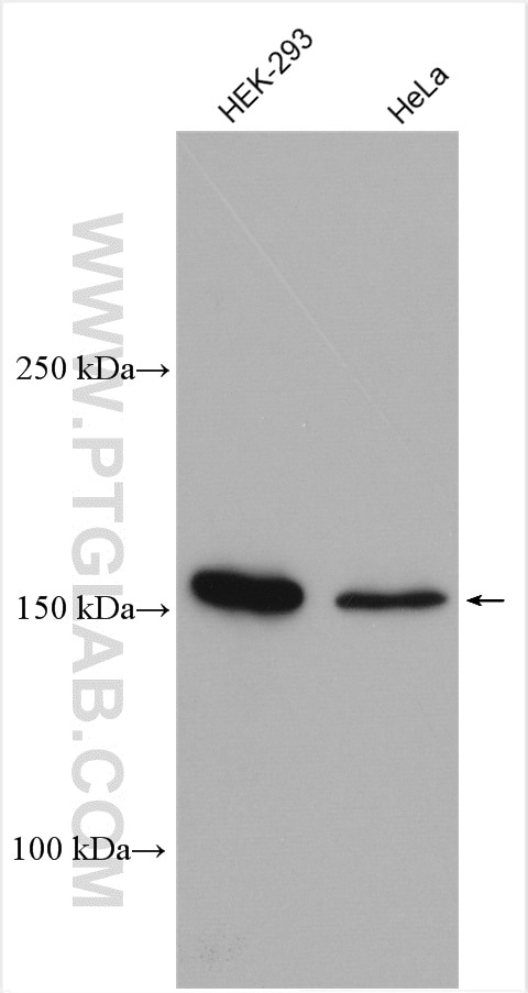 Western Blot (WB) analysis of various lysates using SARA Polyclonal antibody (22033-1-AP)