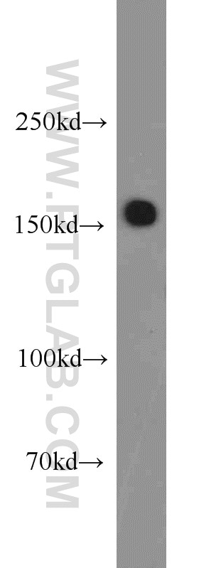 Western Blot (WB) analysis of mouse brain tissue using SARA Polyclonal antibody (22033-1-AP)