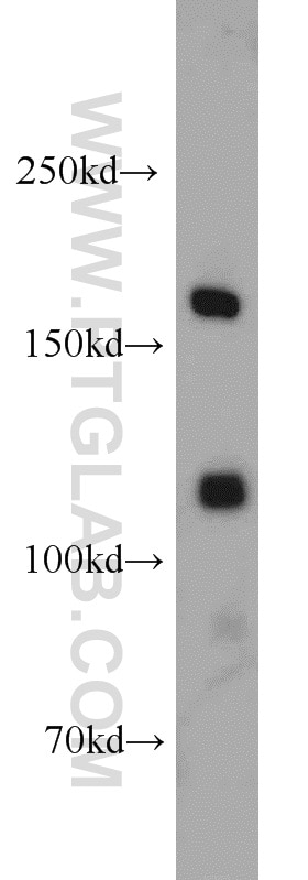 Western Blot (WB) analysis of MCF-7 cells using SARA Polyclonal antibody (22033-1-AP)