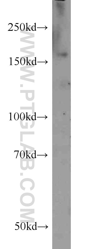 Western Blot (WB) analysis of human brain tissue using SARA Polyclonal antibody (22033-1-AP)