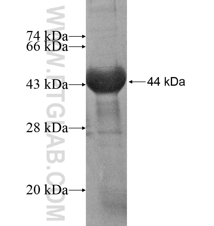 ZFYVE9 fusion protein Ag16929 SDS-PAGE