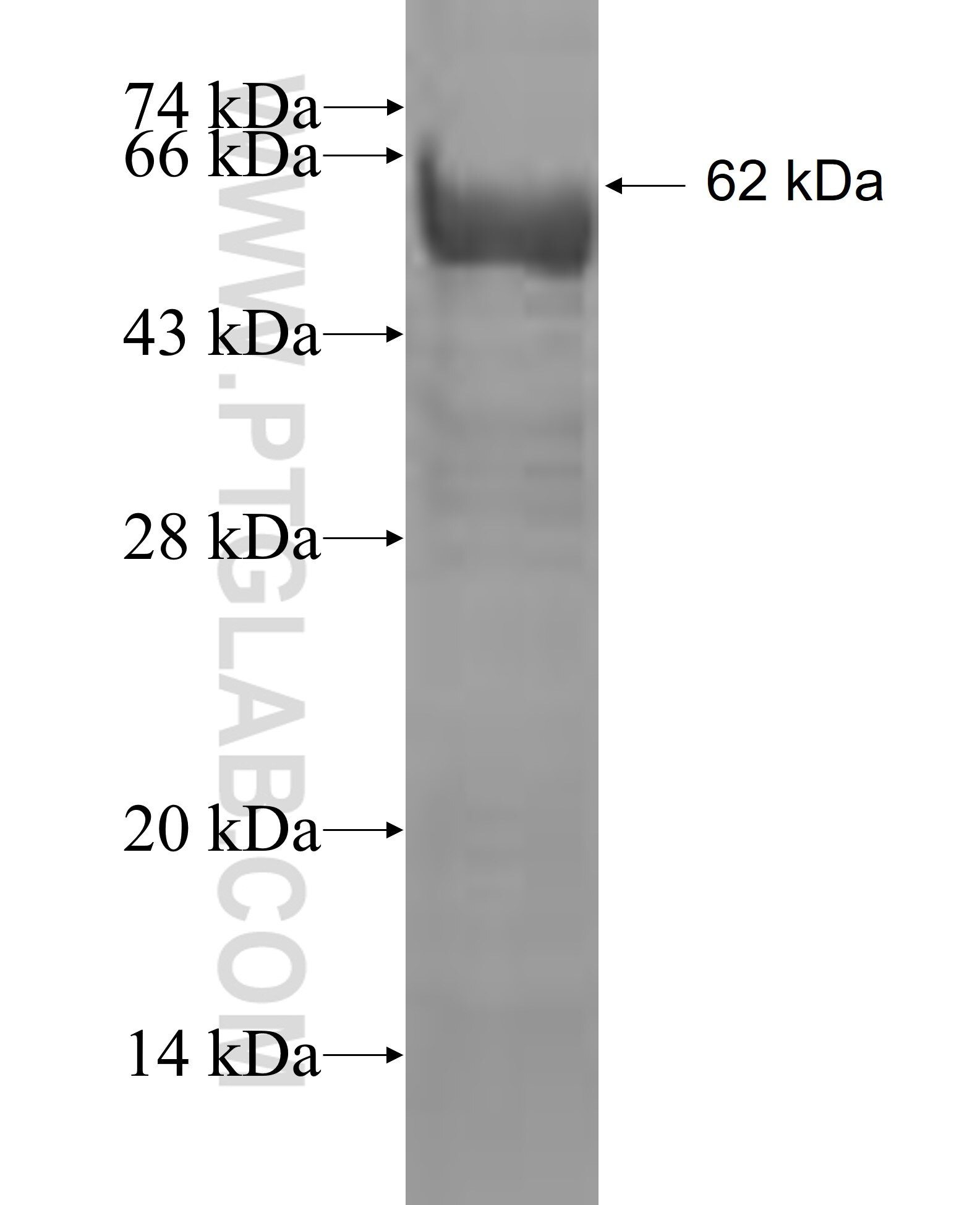 ZFYVE9 fusion protein Ag6592 SDS-PAGE