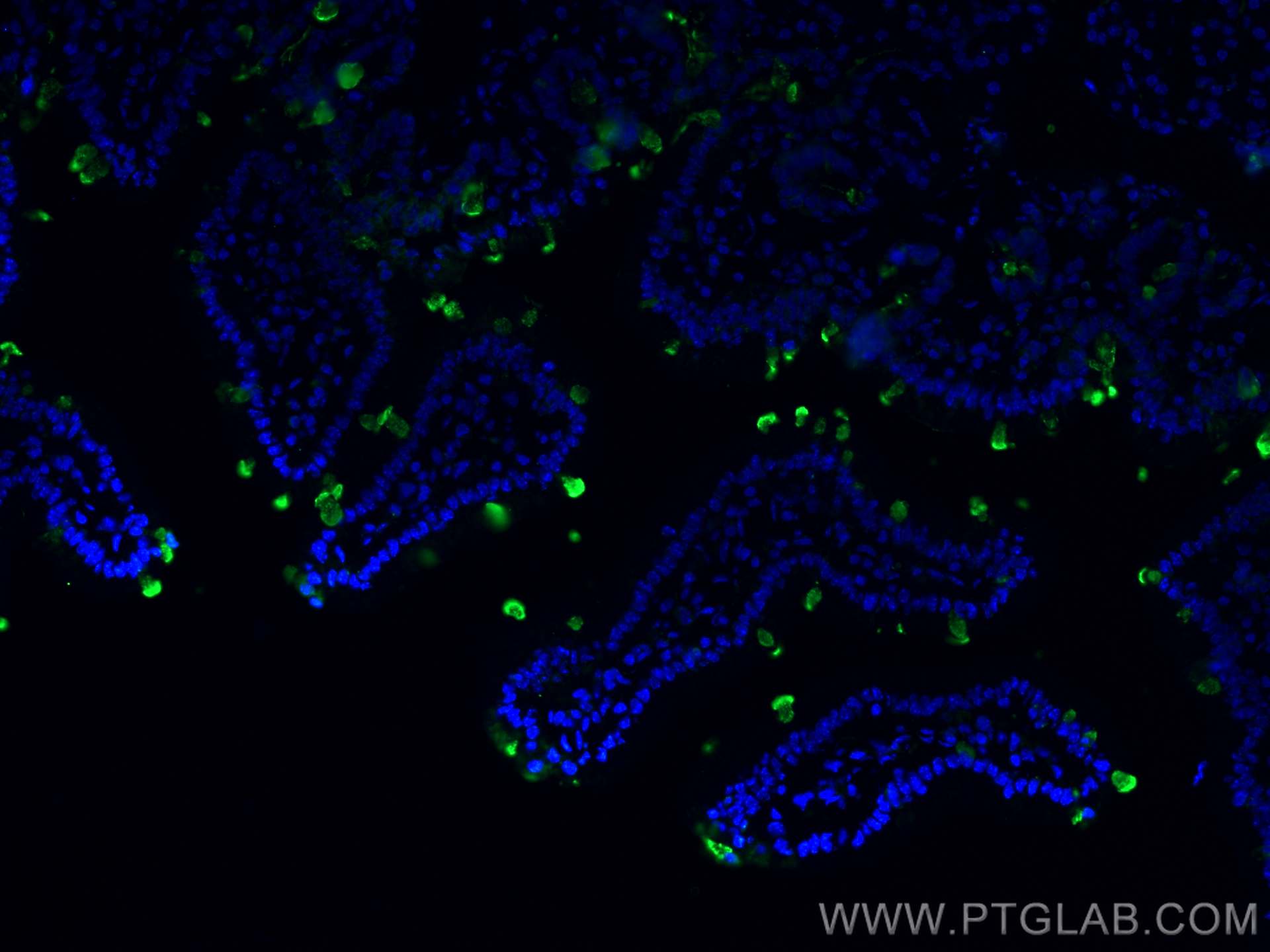 Immunofluorescence (IF) / fluorescent staining of mouse small intestine tissue using ZG16 Polyclonal antibody (17397-1-AP)