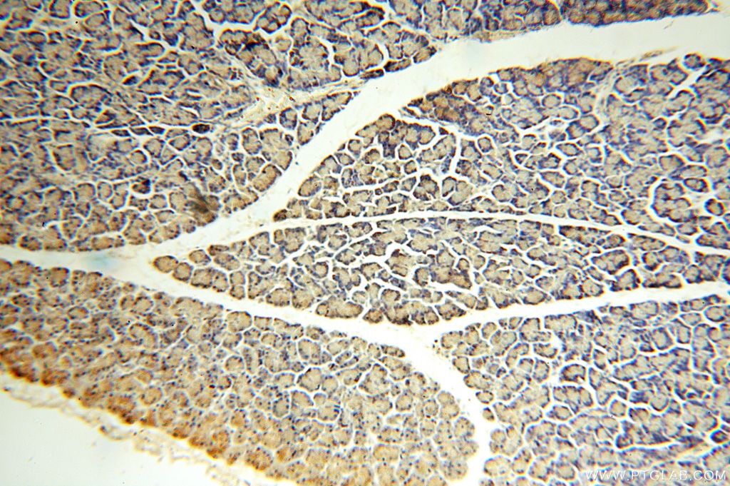 Immunohistochemistry (IHC) staining of human pancreas tissue using ZG16 Polyclonal antibody (17397-1-AP)