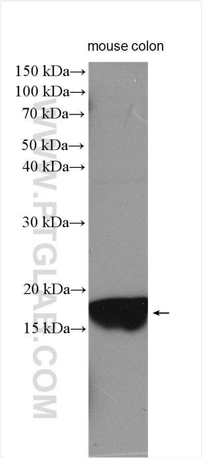 Western Blot (WB) analysis of various lysates using ZG16 Polyclonal antibody (17397-1-AP)