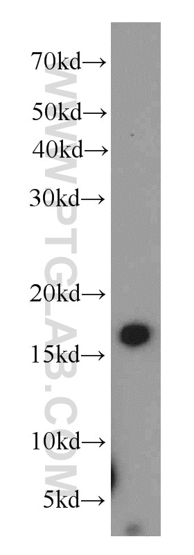 Western Blot (WB) analysis of human colon tissue using ZG16 Polyclonal antibody (17397-1-AP)