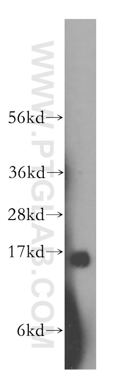 Western Blot (WB) analysis of human colon tissue using ZG16 Polyclonal antibody (17397-1-AP)