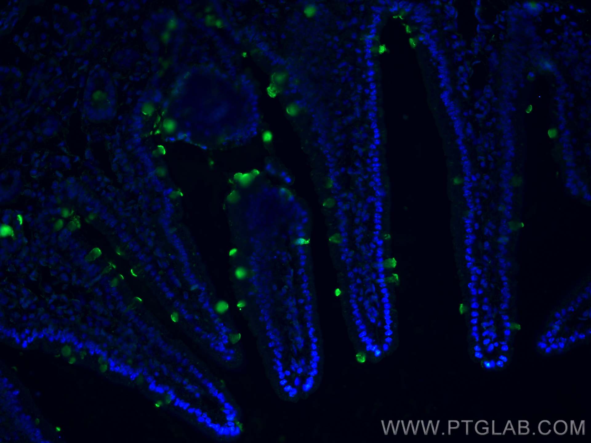 Immunofluorescence (IF) / fluorescent staining of mouse small intestine tissue using ZG16 Monoclonal antibody (67389-1-Ig)