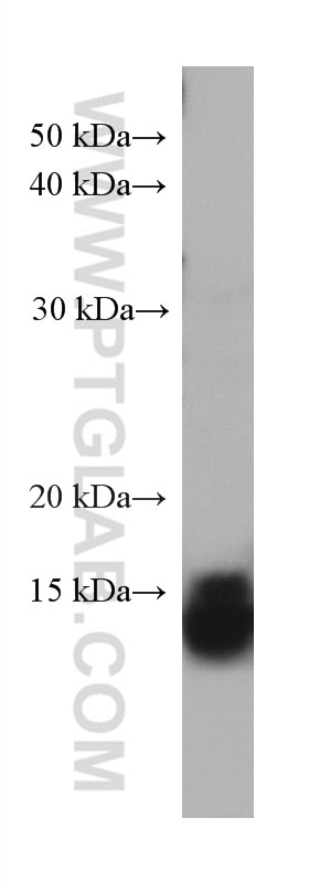 Western Blot (WB) analysis of human colon tissue using ZG16 Monoclonal antibody (67389-1-Ig)