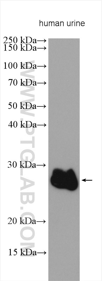 Western Blot (WB) analysis of various lysates using ZG16B Polyclonal antibody (23803-1-AP)