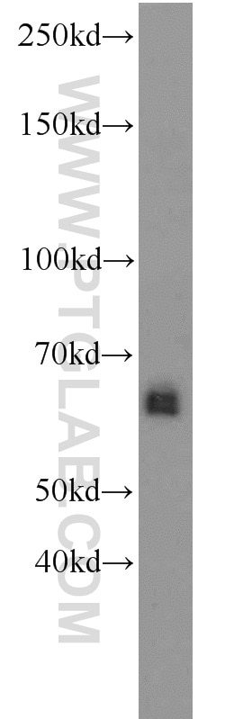 Western Blot (WB) analysis of mouse liver tissue using ZGPAT Polyclonal antibody (23203-1-AP)