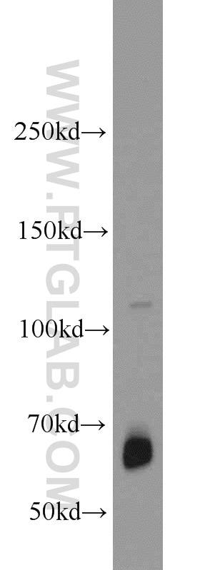 Western Blot (WB) analysis of HepG2 cells using ZGPAT Polyclonal antibody (23203-1-AP)