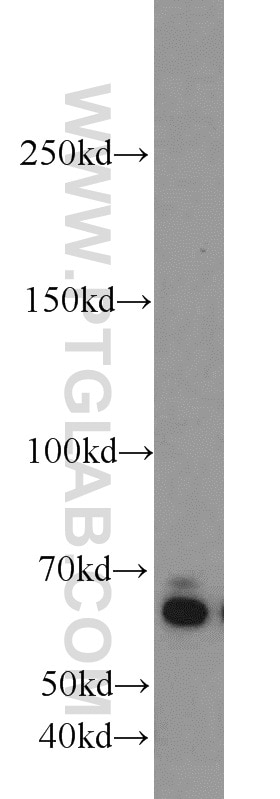 Western Blot (WB) analysis of L02 cells using ZGPAT Polyclonal antibody (23203-1-AP)