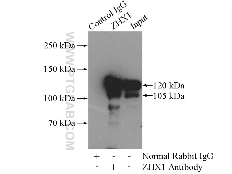 Immunoprecipitation (IP) experiment of HEK-293 cells using ZHX1 Polyclonal antibody (13903-1-AP)