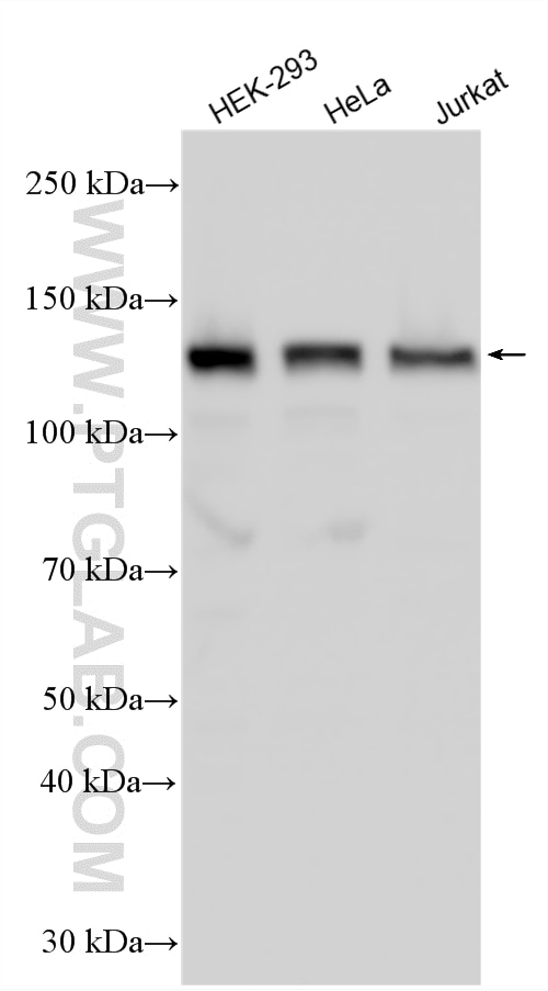Western Blot (WB) analysis of various lysates using ZHX1 Polyclonal antibody (13903-1-AP)