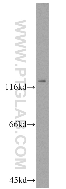 Western Blot (WB) analysis of mouse kidney tissue using ZHX1 Polyclonal antibody (13903-1-AP)