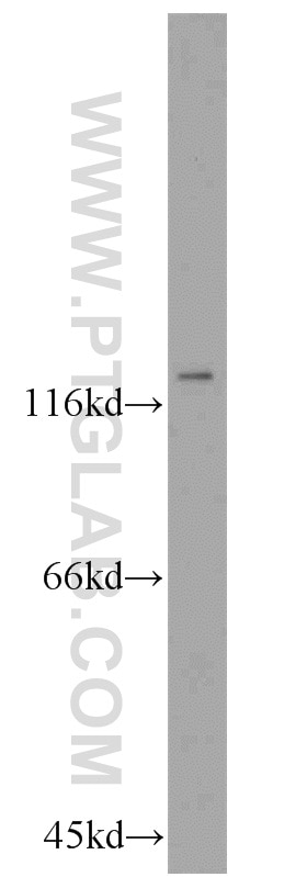 WB analysis of mouse kidney using 13903-1-AP