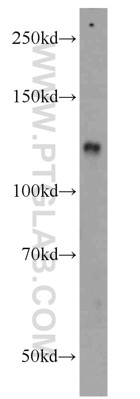 Western Blot (WB) analysis of mouse heart tissue using ZHX1 Polyclonal antibody (13903-1-AP)