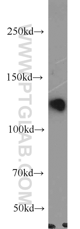 Western Blot (WB) analysis of HEK-293 cells using ZHX1 Polyclonal antibody (13903-1-AP)