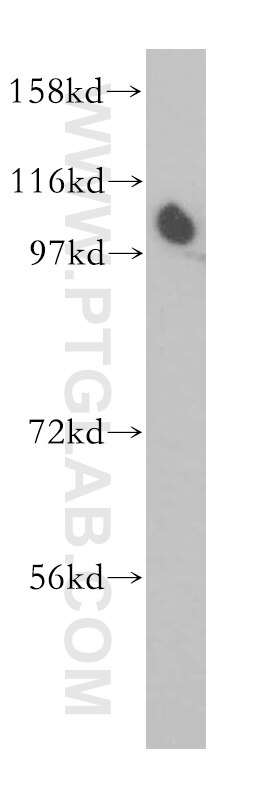 Western Blot (WB) analysis of HeLa cells using ZHX1 Polyclonal antibody (13903-1-AP)