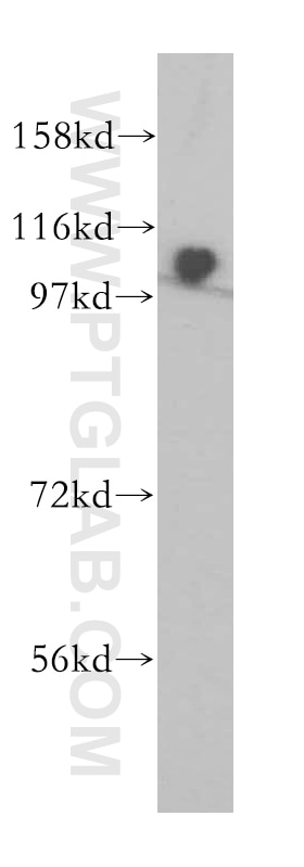 Western Blot (WB) analysis of HeLa cells using ZHX1 Polyclonal antibody (13903-1-AP)