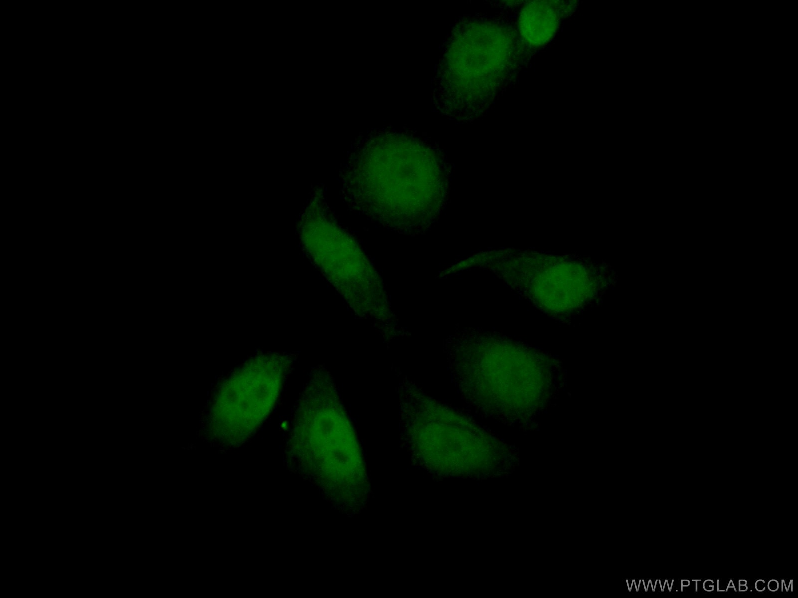 Immunofluorescence (IF) / fluorescent staining of HepG2 cells using ZHX2 Polyclonal antibody (20136-1-AP)