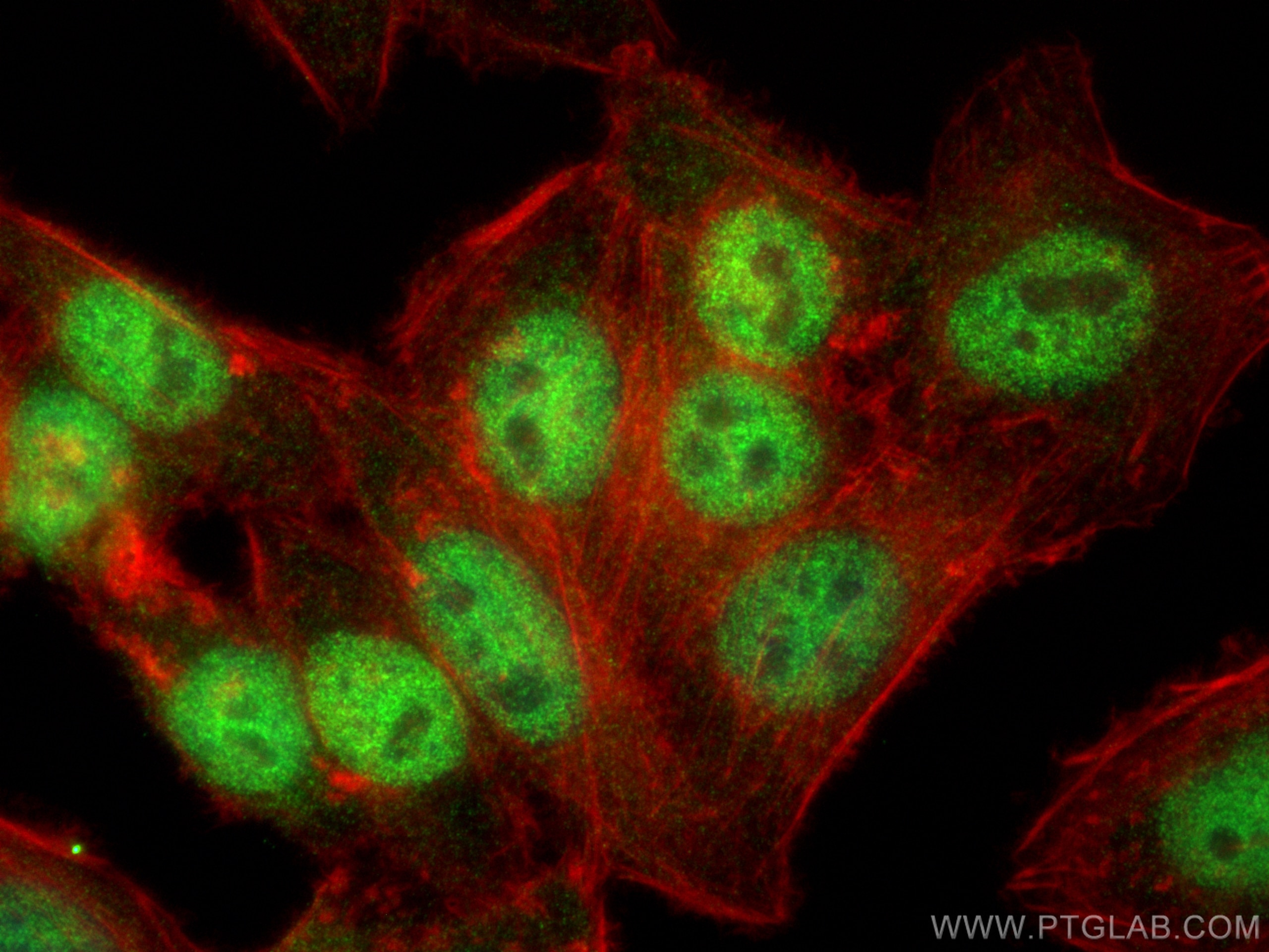 Immunofluorescence (IF) / fluorescent staining of HepG2 cells using ZHX2 Polyclonal antibody (20136-1-AP)