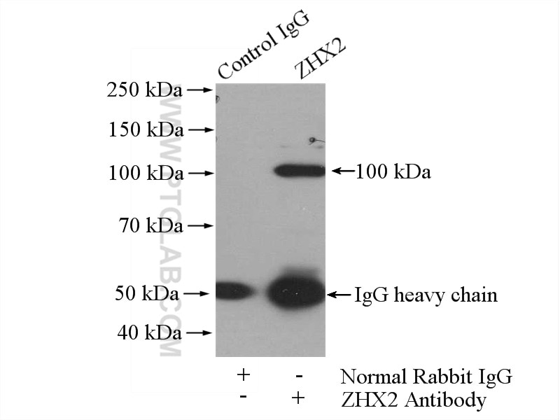 Immunoprecipitation (IP) experiment of mouse brain tissue using ZHX2 Polyclonal antibody (20136-1-AP)
