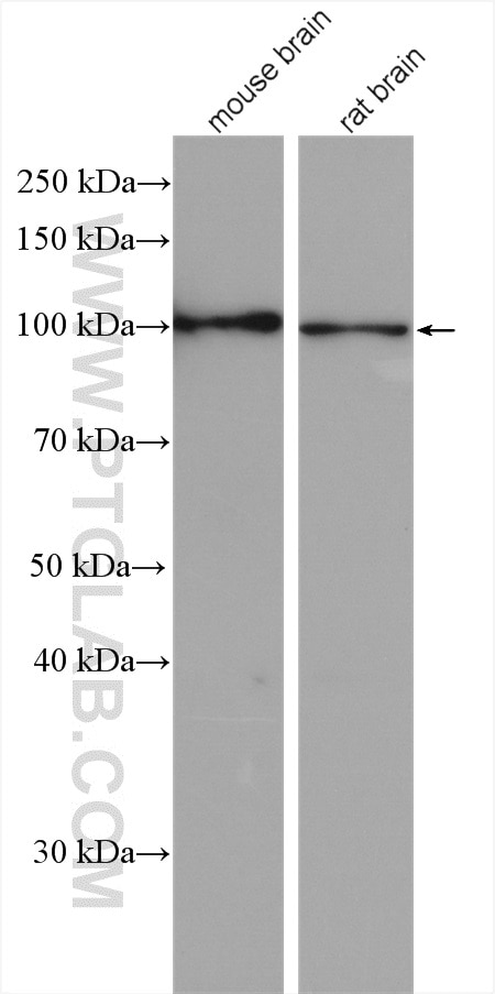 Western Blot (WB) analysis of various lysates using ZHX2 Polyclonal antibody (20136-1-AP)