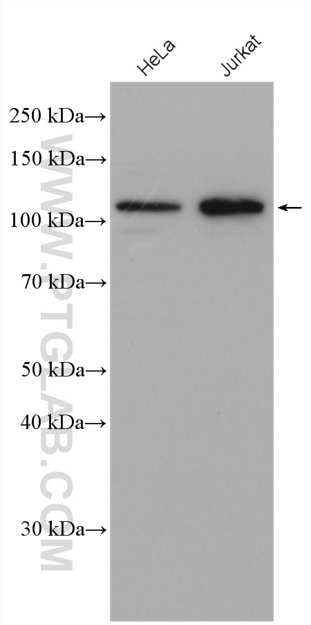 Western Blot (WB) analysis of various lysates using ZHX2 Polyclonal antibody (20136-1-AP)