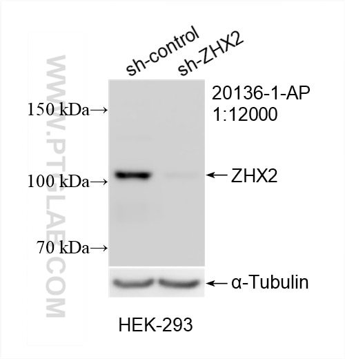 Western Blot (WB) analysis of HEK-293 cells using ZHX2 Polyclonal antibody (20136-1-AP)
