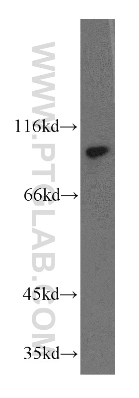Western Blot (WB) analysis of mouse skeletal muscle tissue using ZHX2 Polyclonal antibody (20136-1-AP)