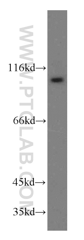 Western Blot (WB) analysis of mouse ovary tissue using ZHX2 Polyclonal antibody (20136-1-AP)