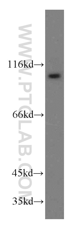 WB analysis of mouse ovary using 20136-1-AP