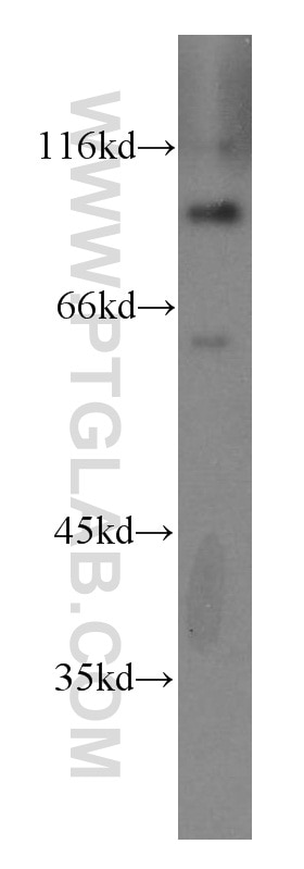 Western Blot (WB) analysis of mouse lung tissue using ZHX2 Polyclonal antibody (20136-1-AP)