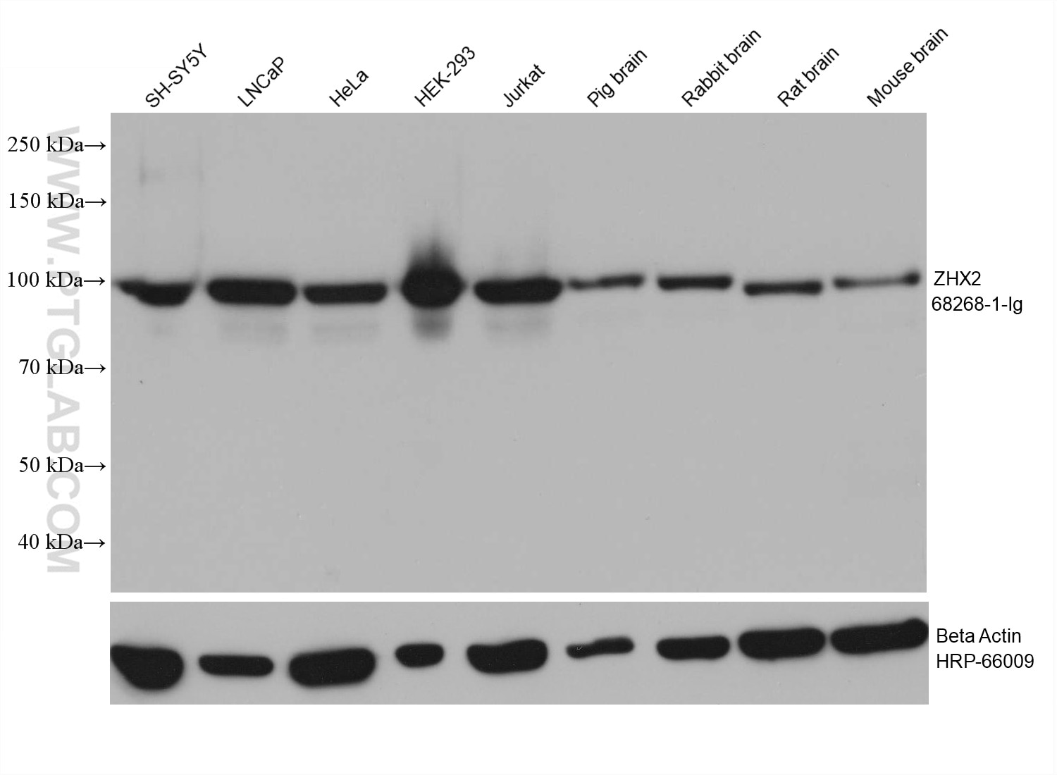 Western Blot (WB) analysis of various lysates using ZHX2 Monoclonal antibody (68268-1-Ig)