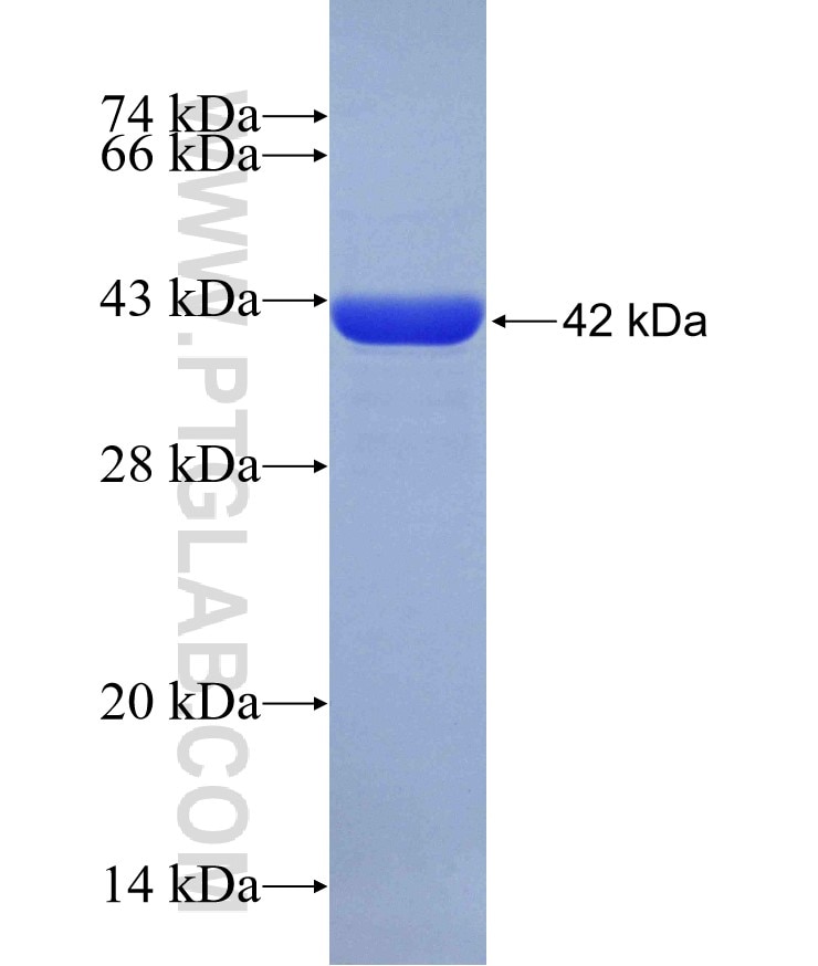 ZHX3 fusion protein Ag30023 SDS-PAGE